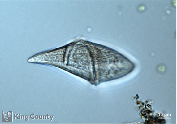 Photo of Gyrodinium spirale